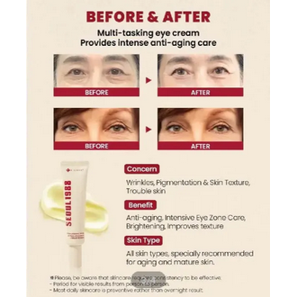 KSECRET SEOUL 1988 EYE CREAM : RETINAL LIPOSOME 4% + FERMENTED BEAN 30ML